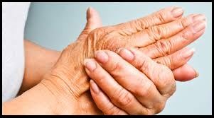 Arthritis is common among seniors